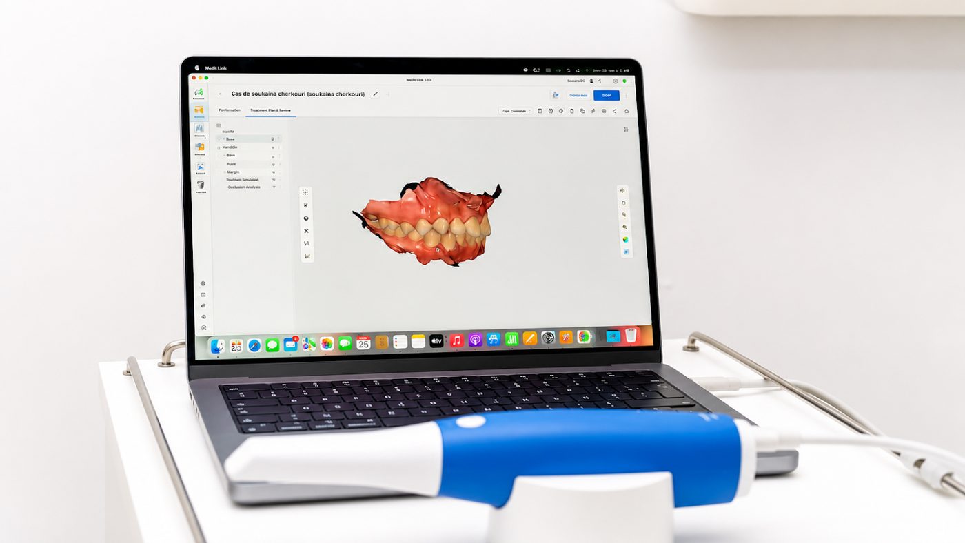 Scanner dentaire 3D — empreinte optique numérique à Casablanca